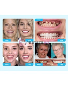 Декоративни изкуствени зъби Snap on Smile